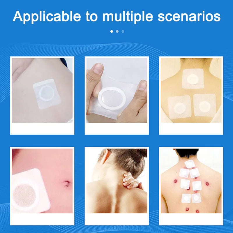 Transparent PU Adhesive Tape – Waterproof Wound Dressing for Medical Fixation
