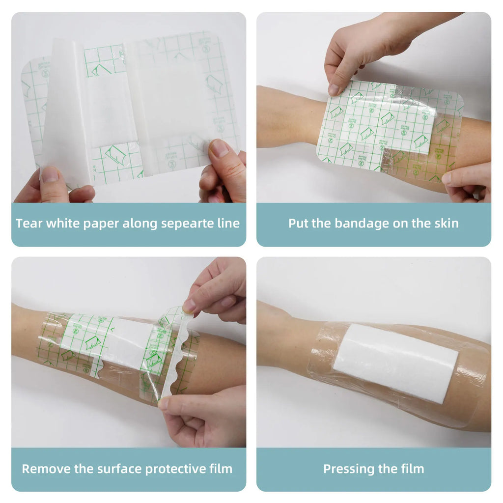 Waterproof PU Adhesive Wound Dressings – 10x15cm First Aid Medical Plasters