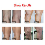 Compression Calf Sleeves – 20-30mmHg Shin Support for Running and Athletics