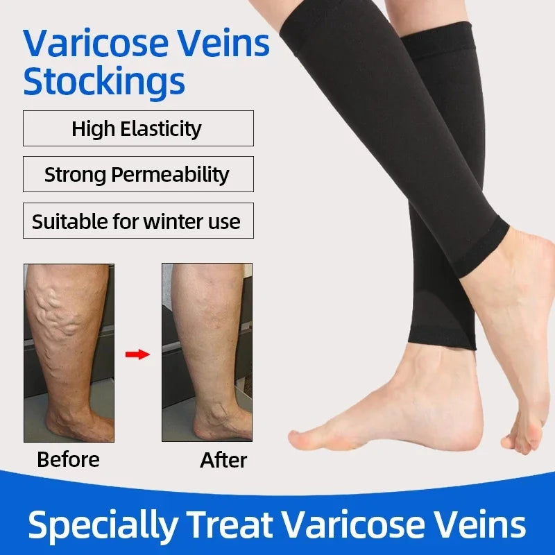Compression Calf Sleeves – 20-30mmHg Shin Support for Running and Athletics