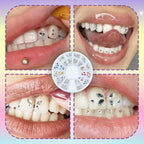 DIY Teeth Gems Kit – Adhesive Rhinestone Set for Dental Jewelry Decoration